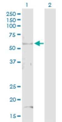 Western Blot: S5a/Angiocidin Antibody [H00005710-D01P]