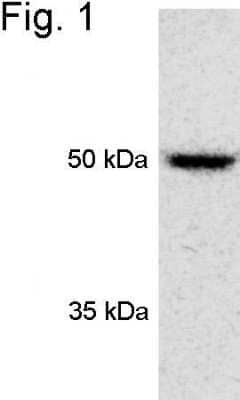 Western Blot: S5a/Angiocidin Antibody [NB120-3318]