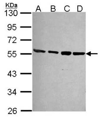 Western Blot: S5a/Angiocidin Antibody [NBP2-19951]