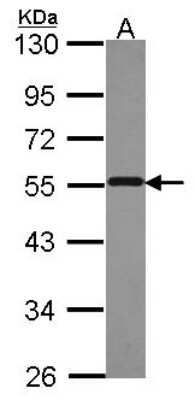 Western Blot: S5a/Angiocidin Antibody [NBP2-19952]