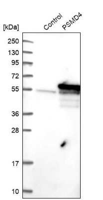 Western Blot: S5a/Angiocidin Antibody [NBP2-37888]