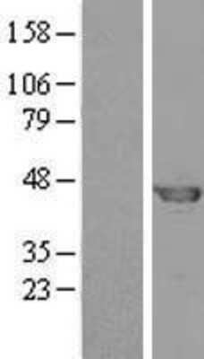 Western Blot: S5a/Angiocidin Overexpression Lysate [NBL1-14902]