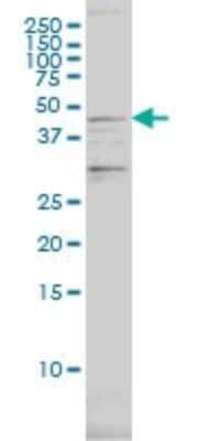 Western Blot: Proteasome 19S S7 Antibody (4C10-2C8) [H00005701-M01]