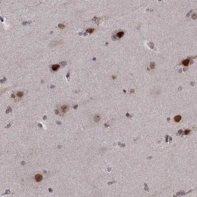 Immunohistochemistry-Paraffin: Proteasome 19S S7 Antibody [NBP1-87797]