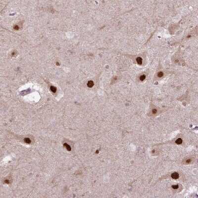 Immunohistochemistry-Paraffin: Proteasome 19S S7 Antibody [NBP2-56743]