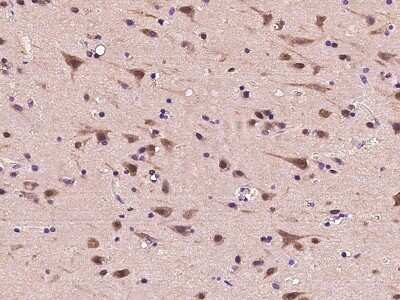 Immunohistochemistry-Paraffin: Proteasome 19S S7 Antibody [NBP2-99611]
