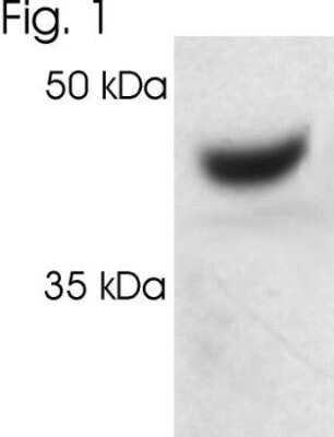 Western Blot: Proteasome 19S S7 Antibody [NB120-3322]