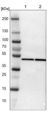 Western Blot: Proteasome 19S S7 Antibody [NBP1-87797]