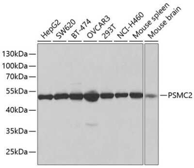 Western Blot: Proteasome 19S S7 AntibodyBSA Free [NBP2-93681]