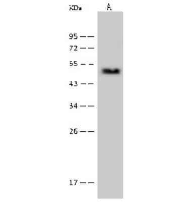 Western Blot: Proteasome 19S S7 Antibody [NBP2-99611]