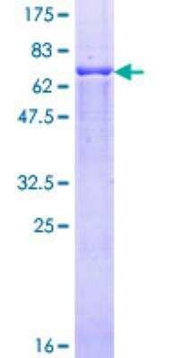 SDS-PAGE: Recombinant Human Proteasome 19S S7 GST (N-Term) Protein [H00005701-P01]