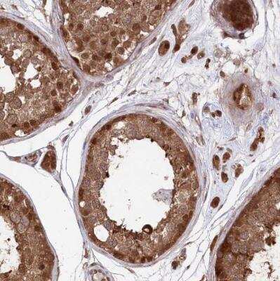 Immunohistochemistry-Paraffin: PSMA1 Antibody [NBP1-81768]