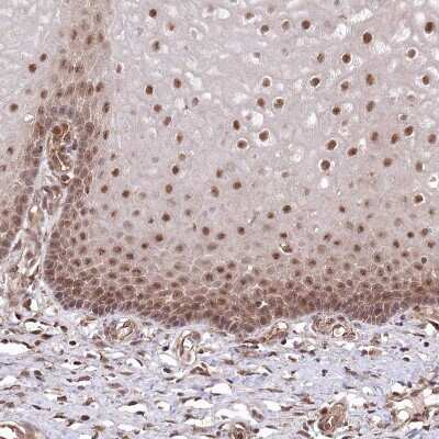 Immunohistochemistry-Paraffin: PSMA1 Antibody [NBP1-81768]