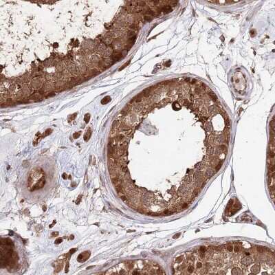 Immunohistochemistry-Paraffin: PSMA1 Antibody [NBP1-81768]