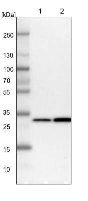 Western Blot: PSMA1 Antibody [NBP1-81768]