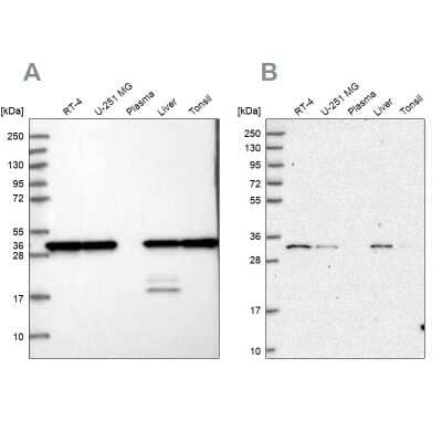 Western Blot: PSMA1 Antibody [NBP1-81768]