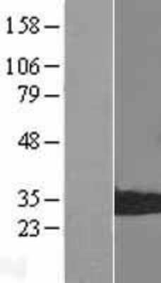 Western Blot: LMP7/PSMB8 Overexpression Lysate [NBL1-14884]