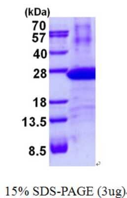 SDS-PAGE: Recombinant Human LMP7/PSMB8 His Protein [NBP2-23374]