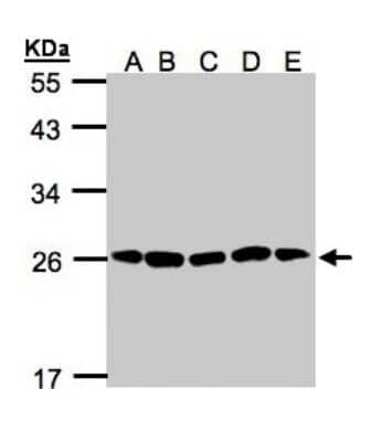 Western Blot: PSMA2 Antibody [NBP1-31542]