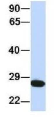 Western Blot: PSMA2 Antibody [NBP1-54633]