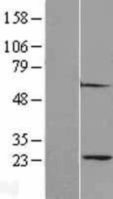 Western Blot: PSMA2 Overexpression Lysate [NBL1-14872]