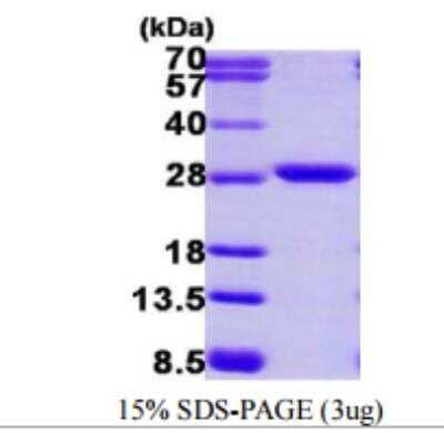 SDS-PAGE: Recombinant Human PSMA2 His Protein [NBP1-72473]