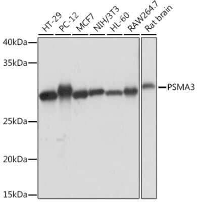 Western Blot: Proteasome 20S alpha 3 Antibody (7X8W9) [NBP3-16551]