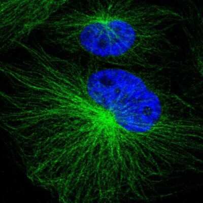 Immunocytochemistry/ Immunofluorescence: Proteasome 20S alpha 3 Antibody [NBP1-92293]