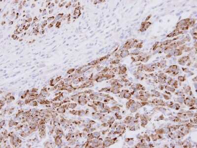Immunohistochemistry-Paraffin: Proteasome 20S alpha 3 Antibody [NBP1-33537]