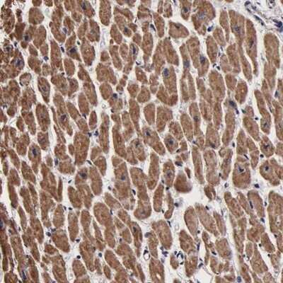 Immunohistochemistry-Paraffin: Proteasome 20S alpha 3 Antibody [NBP1-92293]