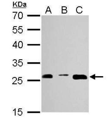 Western Blot: Proteasome 20S alpha 3 Antibody [NBP1-33537]