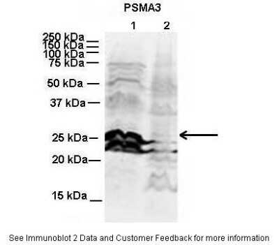 Western Blot: Proteasome 20S alpha 3 Antibody [NBP1-54374]