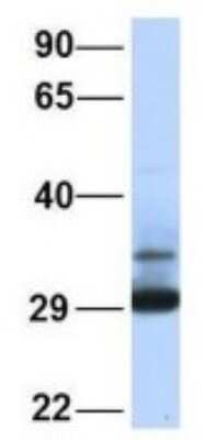 Western Blot: Proteasome 20S alpha 3 Antibody [NBP1-54374]