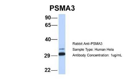 Western Blot: Proteasome 20S alpha 3 Antibody [NBP1-54374]