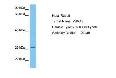 Western Blot: Proteasome 20S alpha 3 Antibody [NBP2-88095]