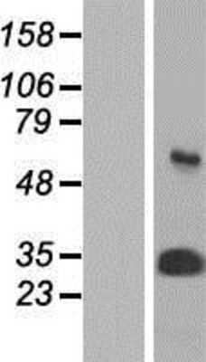 Western Blot: Proteasome 20S alpha 3 Overexpression Lysate [NBP2-10848]