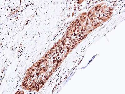 Immunohistochemistry-Paraffin: Proteasome 20S alpha 5 Antibody [NBP1-32387]