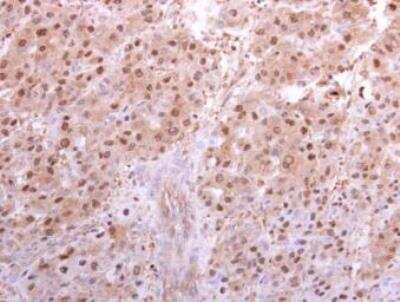 Immunohistochemistry-Paraffin: Proteasome 20S alpha 5 Antibody [NBP1-32387]