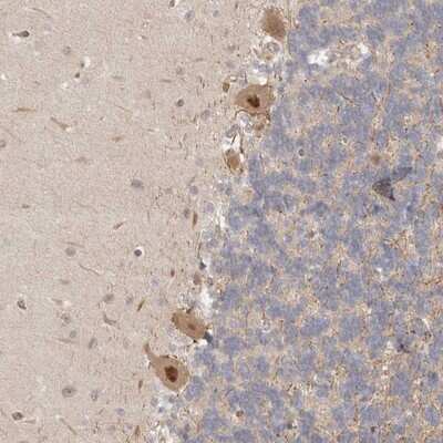 Immunohistochemistry-Paraffin: Proteasome 20S alpha 5 Antibody [NBP1-86837]