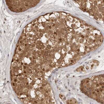 Immunohistochemistry-Paraffin: Proteasome 20S alpha 5 Antibody [NBP1-86838]