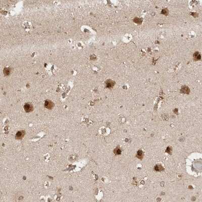 Immunohistochemistry-Paraffin: Proteasome 20S alpha 5 Antibody [NBP1-86839]