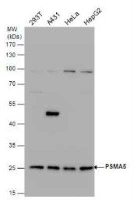 Western Blot: Proteasome 20S alpha 5 Antibody [NBP1-32387]