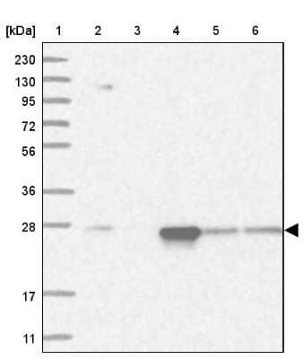 Western Blot: Proteasome 20S alpha 5 Antibody [NBP1-86837]