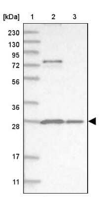 Western Blot: Proteasome 20S alpha 5 Antibody [NBP1-86839]