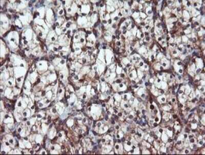 Immunohistochemistry: Proteasome 20S alpha 6 Antibody (OTI3B8) [NBP2-45419]