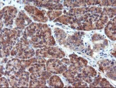 Immunohistochemistry: Proteasome 20S alpha 6 Antibody (OTI3B8) [NBP2-45419]
