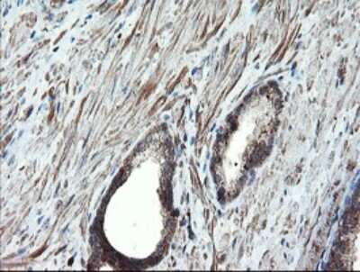 Immunohistochemistry: Proteasome 20S alpha 6 Antibody (OTI3B8) [NBP2-45419]