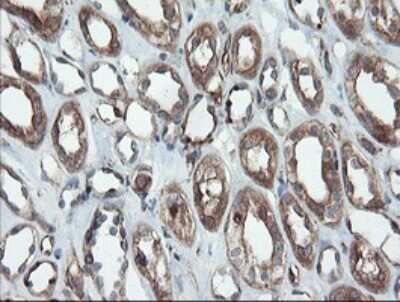 Immunohistochemistry: Proteasome 20S alpha 6 Antibody (OTI3B8) [NBP2-45419]