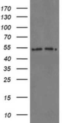 Western Blot: Proteasome 20S alpha 6 Antibody (OTI3B8) [NBP2-45419]