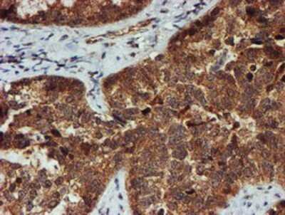 Immunohistochemistry-Paraffin: Proteasome 20S alpha 6 Antibody (OTI4C9) [NBP2-03836]